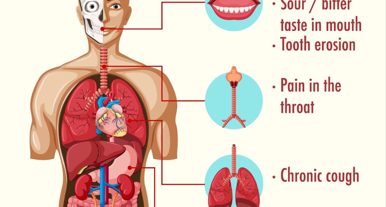 Understanding the Sudden Onset of Heartburn