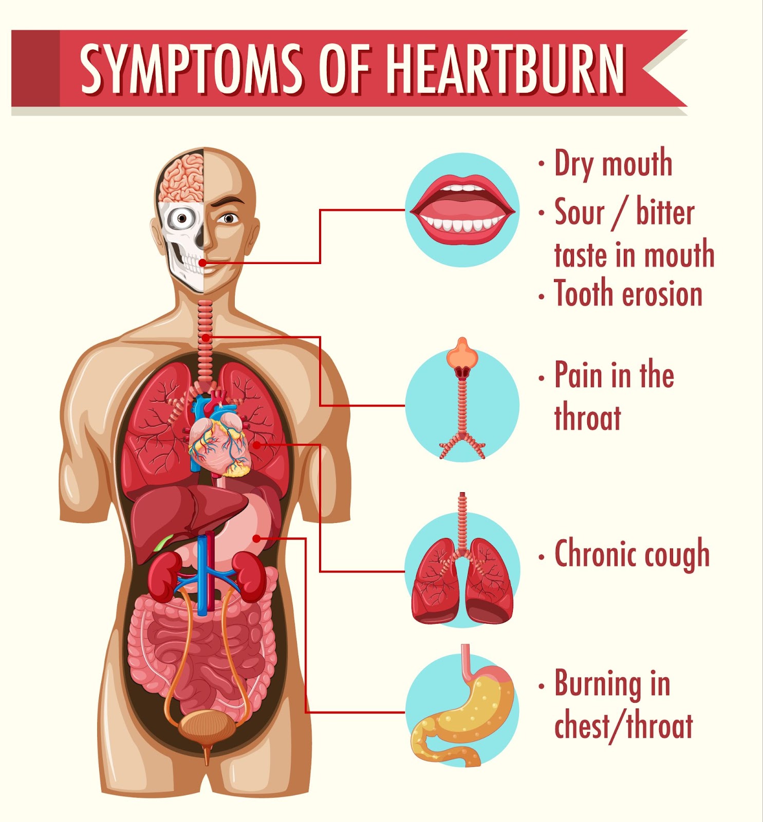 Symptoms of heartburn information infographic